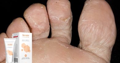Nomidol крем от грибка ног: быстрое лечение инфекции