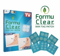 Formu Clear: Отзывы Реальные Покупателей о Пластырях от Бородавок и Папиллом