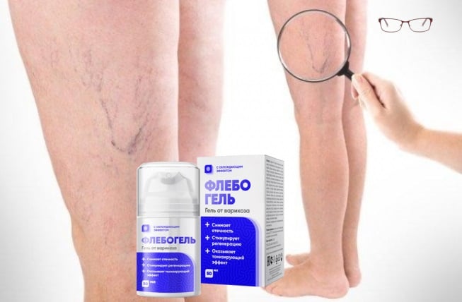 флебогель от варикоза